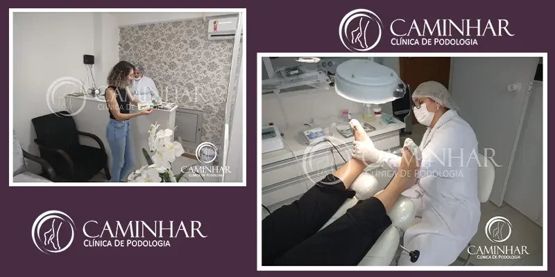 Caminhar – Clínica de Podologia