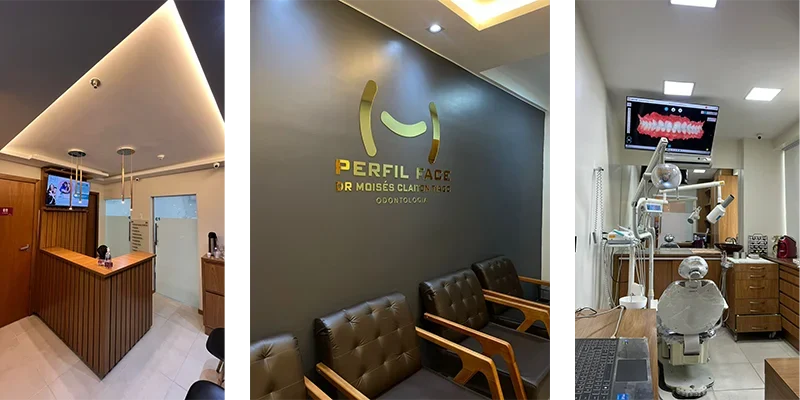 Perfil Face – Odontologia