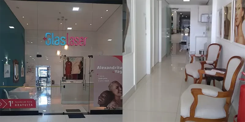 fotos-glas-laser-patio-capital-taguatinga